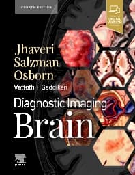Image - Diagnostic Imaging: Brain