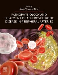 Image - Pathophysiology and Treatment of Atherosclerotic Disease in Peripheral Arteries