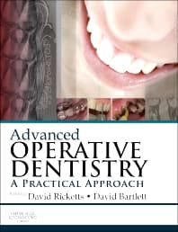 Image - Advanced Operative Dentistry