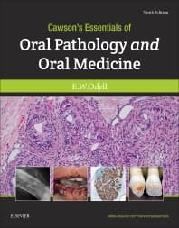 Image - Cawson's Essentials of Oral Pathology and Oral Medicine